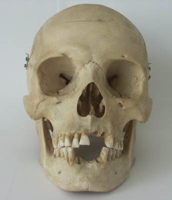 human skull front. human destruction occurs,